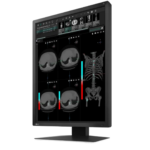 Moniteur Médical EIZO RadiForce MX215 – Écran Couleur 21,3″ LCD Haute Précision – Made in Japan – Image 2