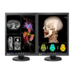 Moniteur Médical EIZO RadiForce MX215 – Écran Couleur 21,3″ LCD Haute Précision – Made in Japan – Image 3